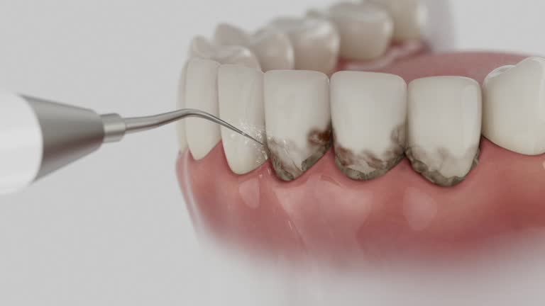 Reliable Emergency Dentist contractor in Pulaski, NY by Smile Center Dentistry
